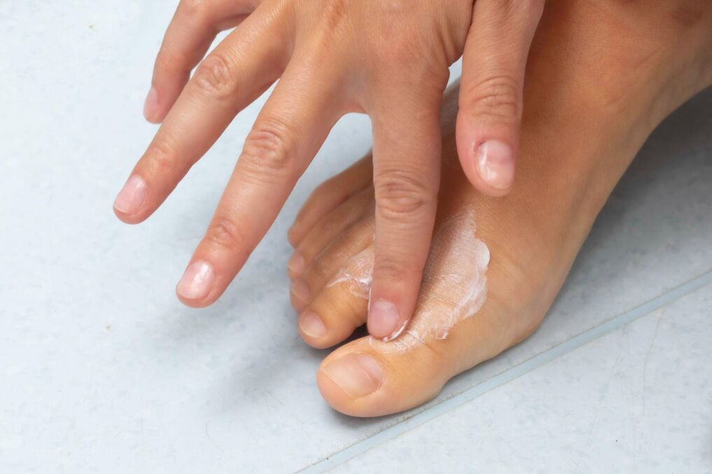 Demyxil Crème vum Pilz tëscht den Zänn